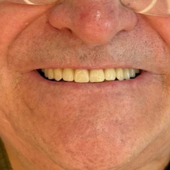 pp (2)